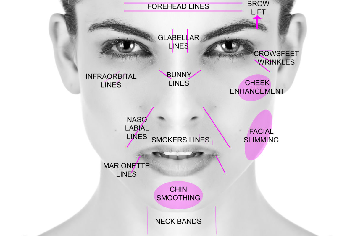 Botox and Fillers Rejuvenation Pelosi Medical Center Advanced Gynecology and Cosmetic