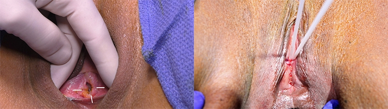 Before and After Image: Patient 2 - front