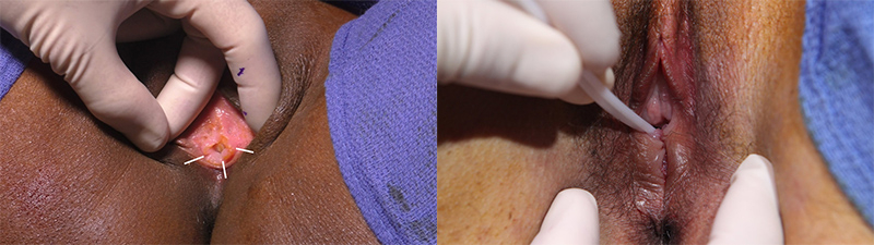 Before and After Image: Patient 2 - front