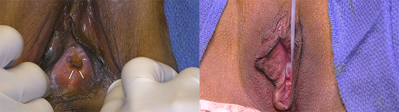 Before and After Image: Patient 2 - front